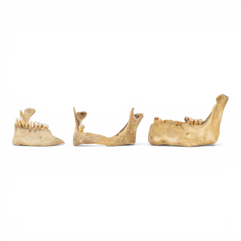 Real Human Mandible - Pathology - Set Of 3