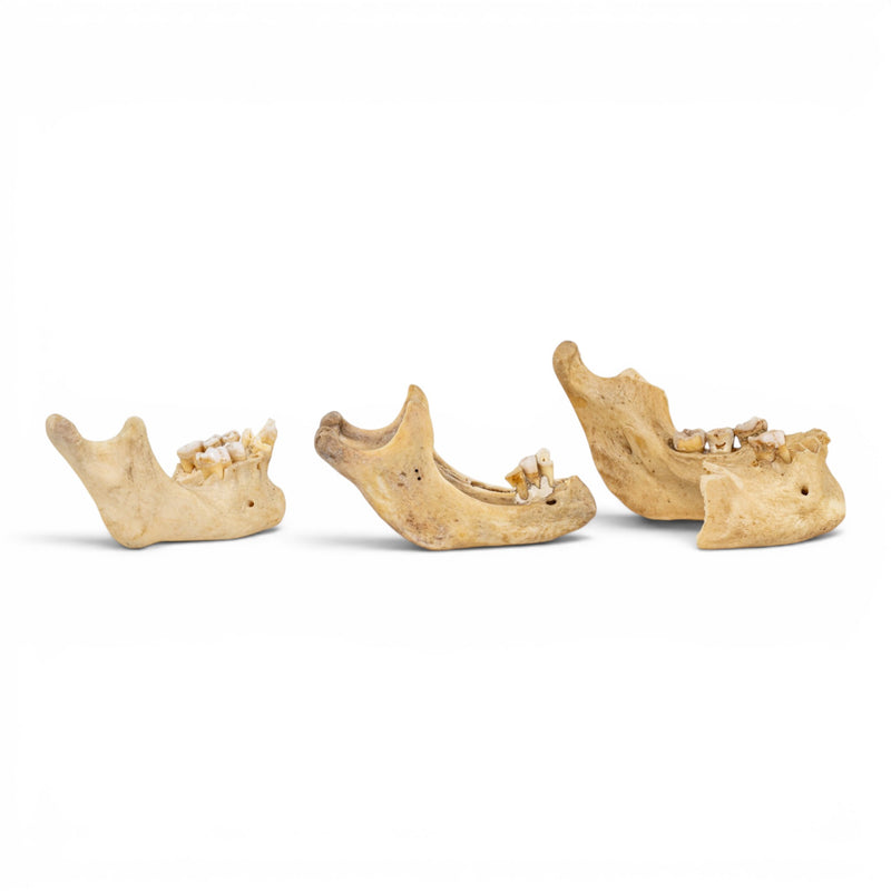 Real Human Mandible - Pathology - Set Of 3