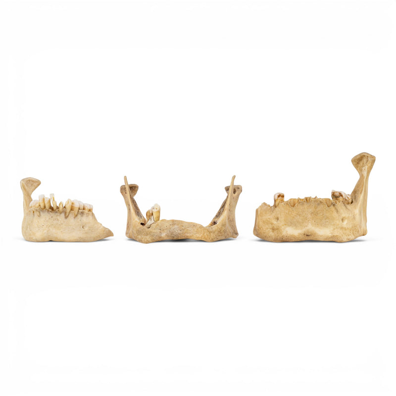 Real Human Mandible - Pathology - Set Of 3