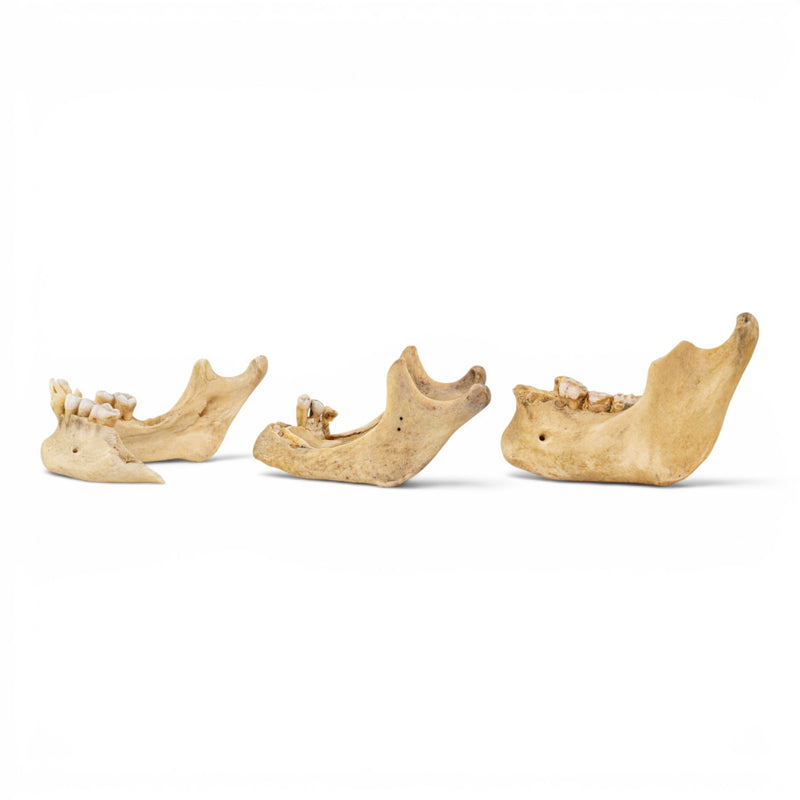 Real Human Mandible - Pathology - Set Of 3
