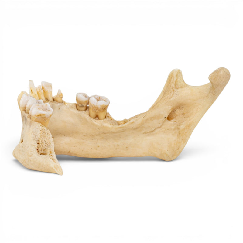 Real Human Mandible - Pathology - Set Of 3