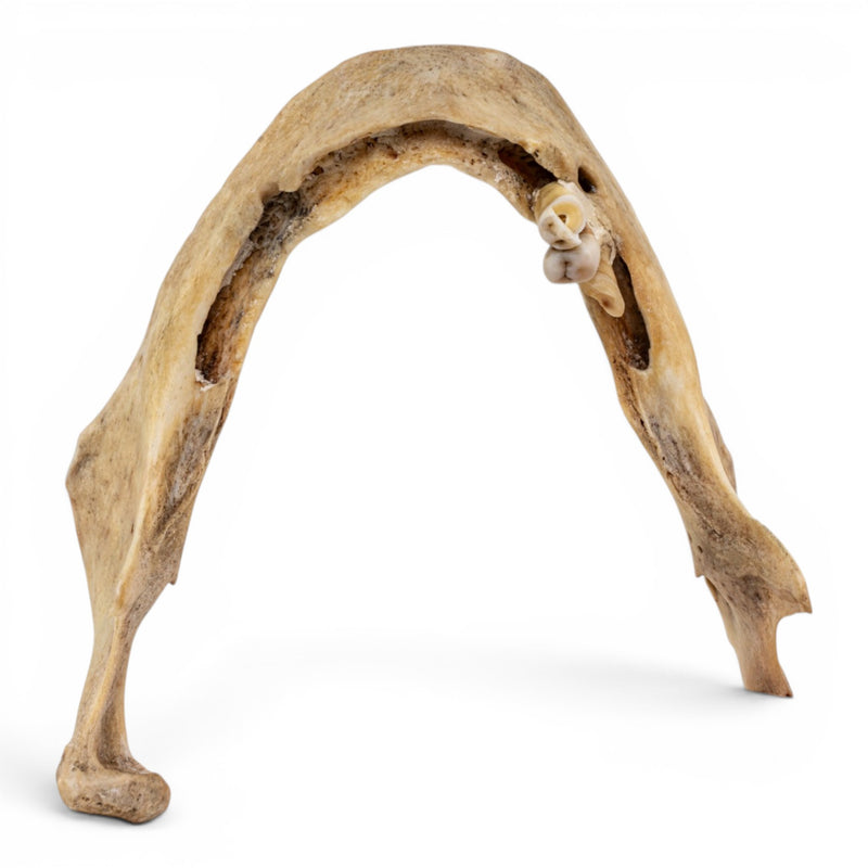 Real Human Mandible - Pathology - Set Of 3