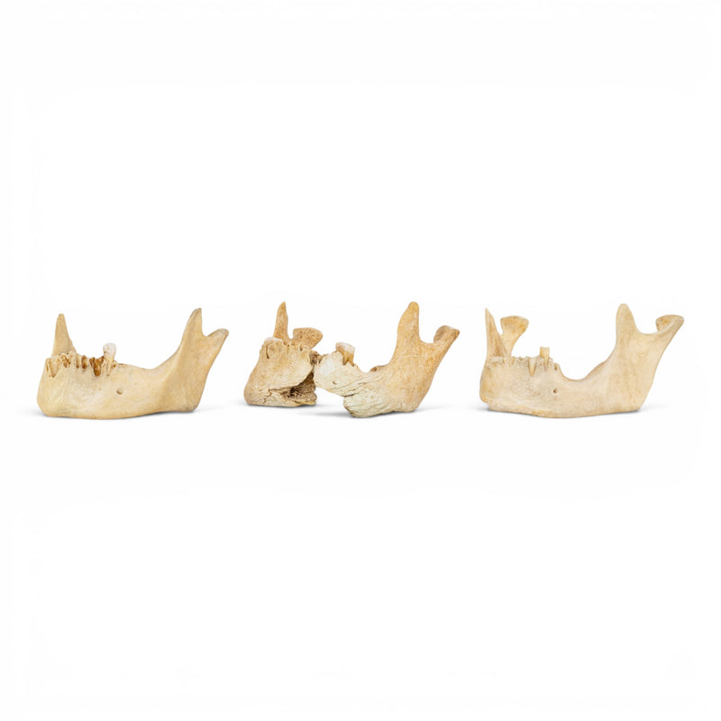 Real Human Mandible - Pathology - Set Of 3