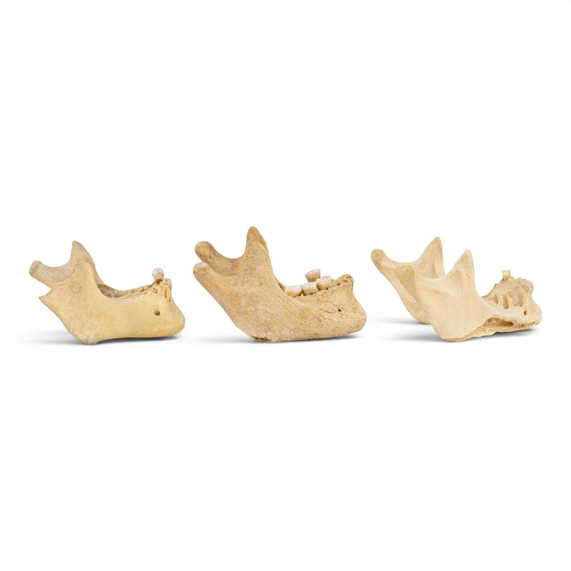 Real Human Mandible - Pathology - Set Of 3
