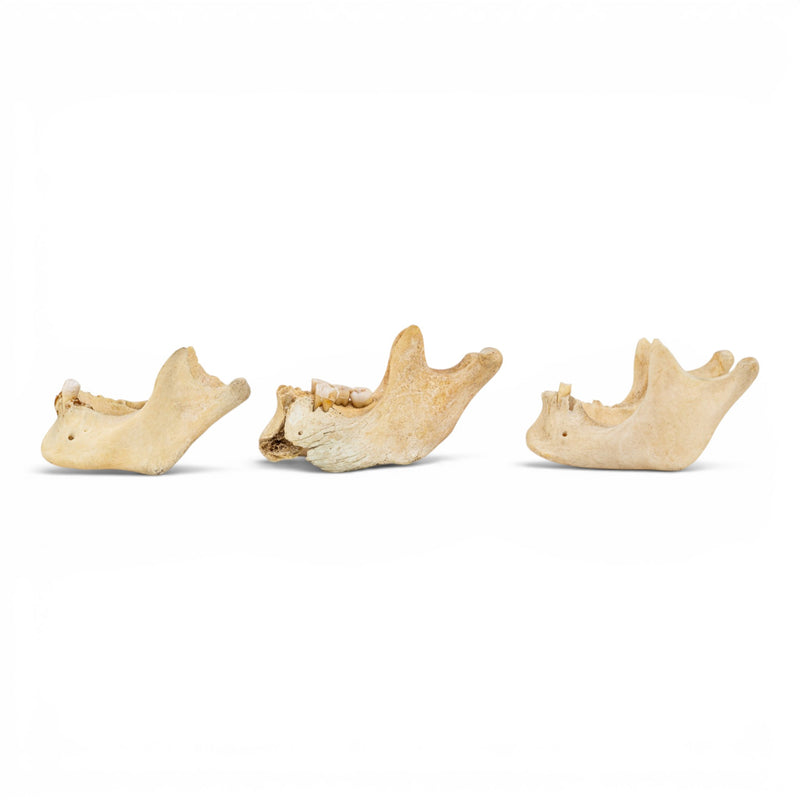 Real Human Mandible - Pathology - Set Of 3