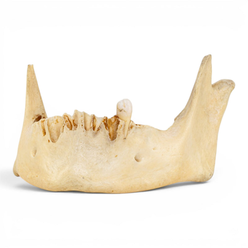 Real Human Mandible - Pathology - Set Of 3
