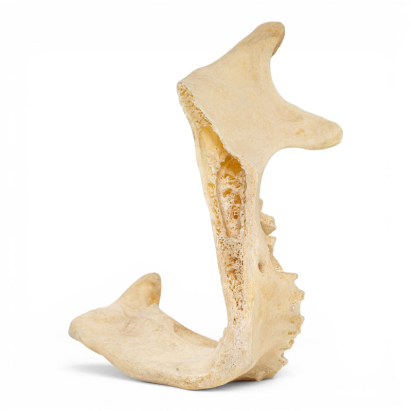 Real Human Mandible - Pathology - Set Of 3