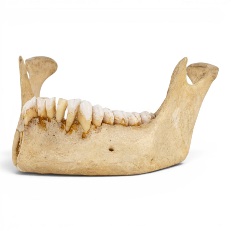 Real Human Mandible - Dissected