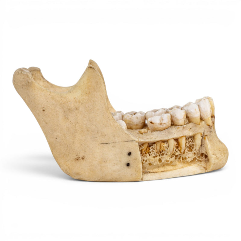 Real Human Mandible - Dissected