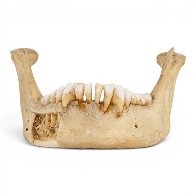 Real Human Mandible - Dissected