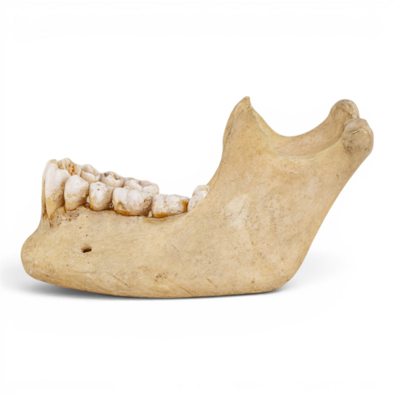 Real Human Mandible - Dissected