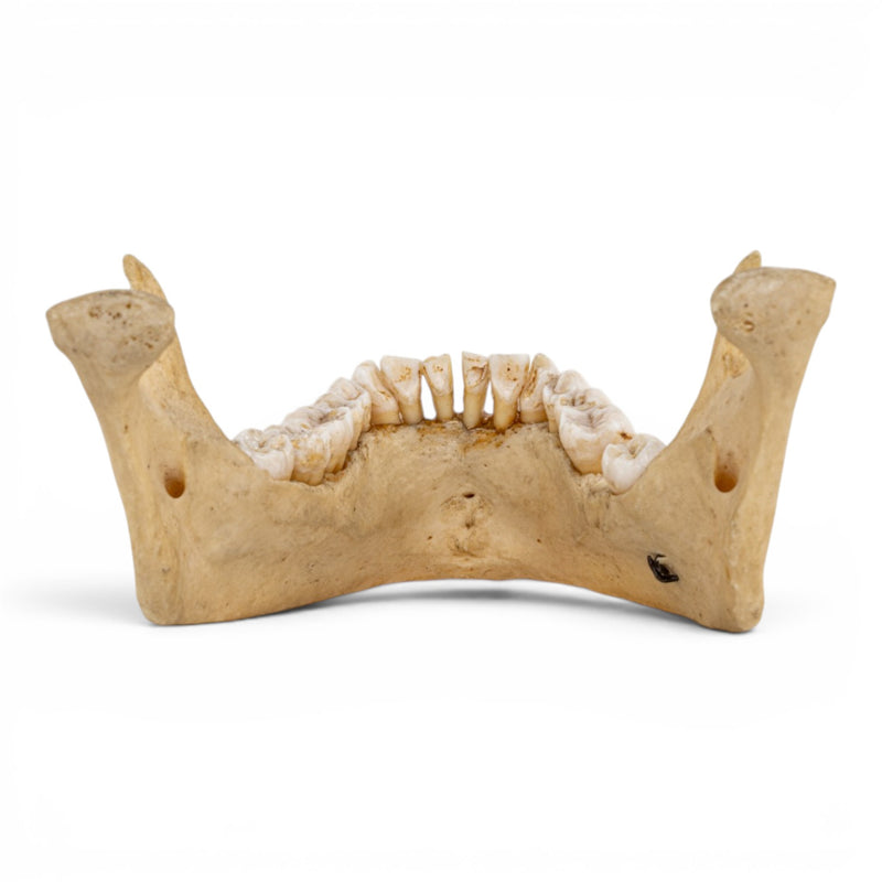 Real Human Mandible - Dissected