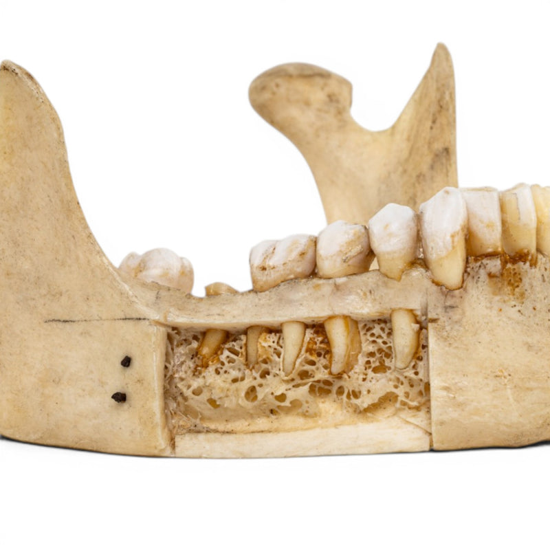Real Human Mandible - Dissected
