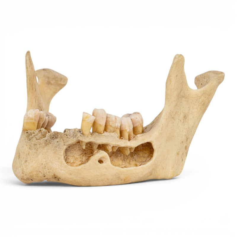 Real Human Mandible - Dissected