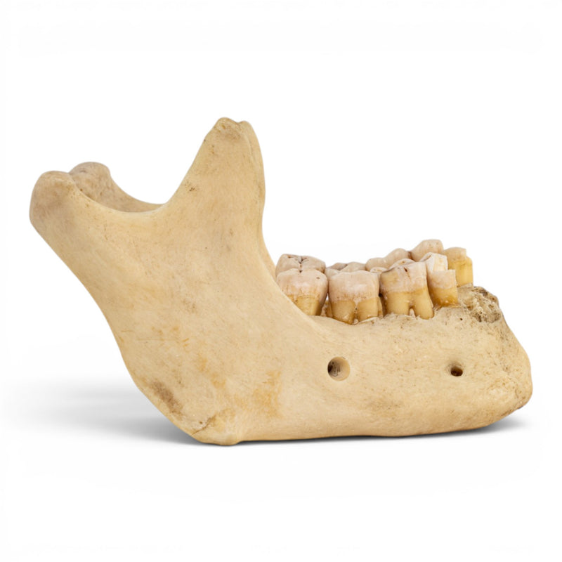 Real Human Mandible - Dissected