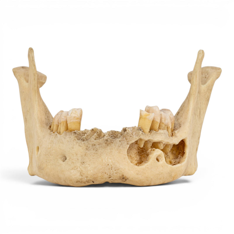 Real Human Mandible - Dissected