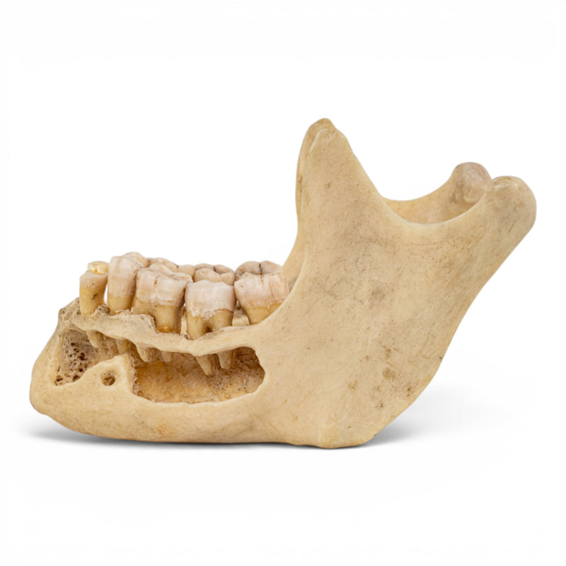 Real Human Mandible - Dissected