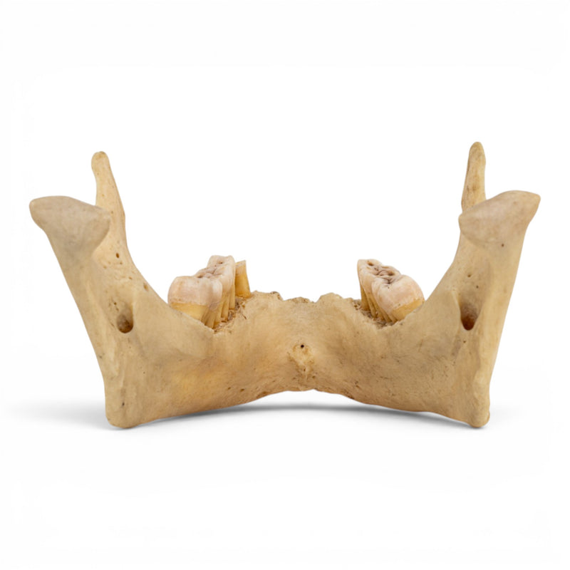 Real Human Mandible - Dissected