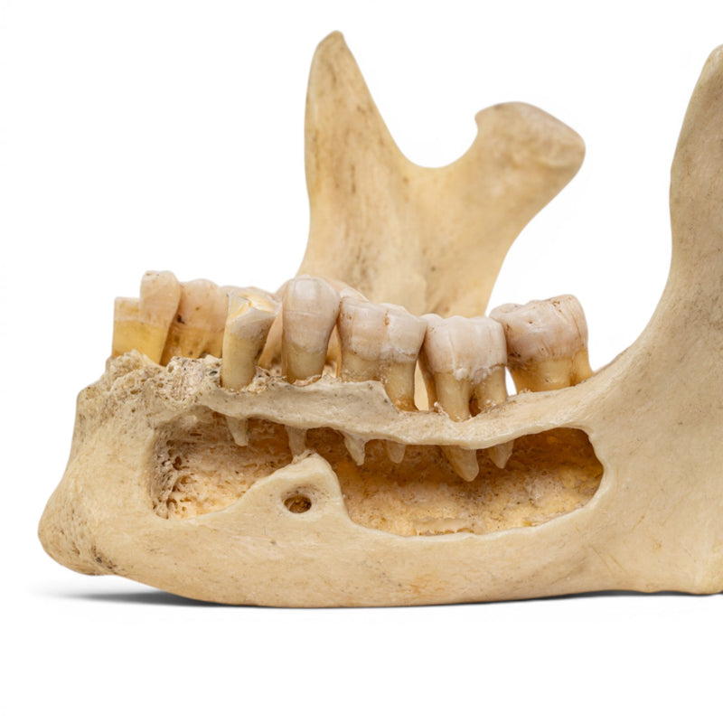 Real Human Mandible - Dissected