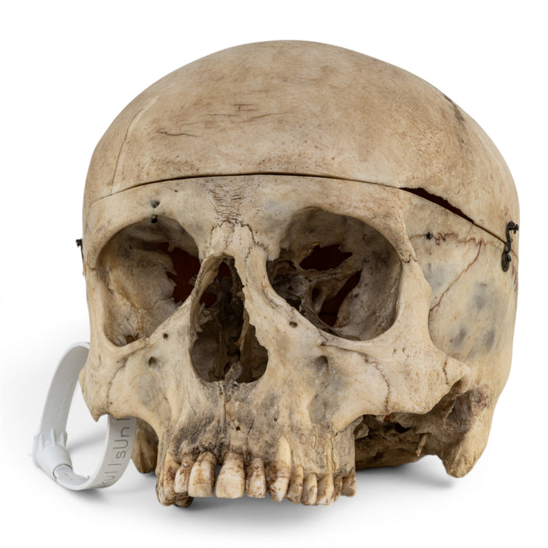 Real Human Skull No Jaw