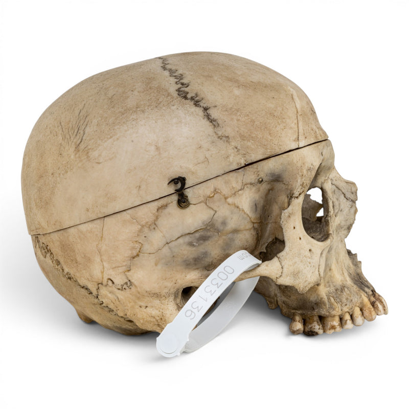 Real Human Skull No Jaw