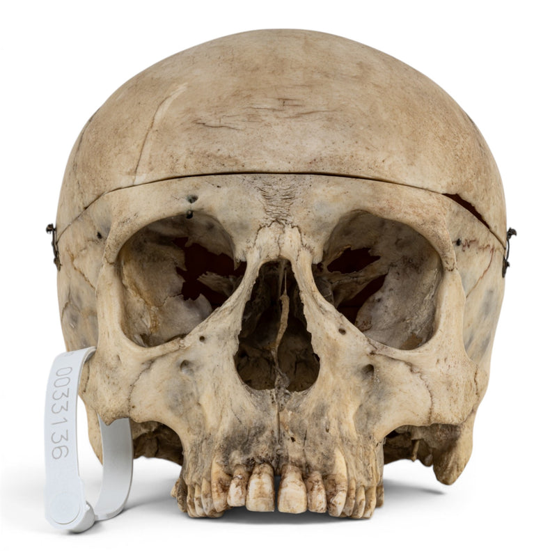 Real Human Skull No Jaw