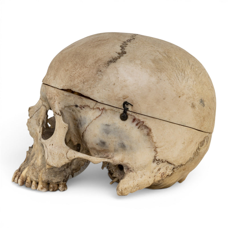 Real Human Skull No Jaw