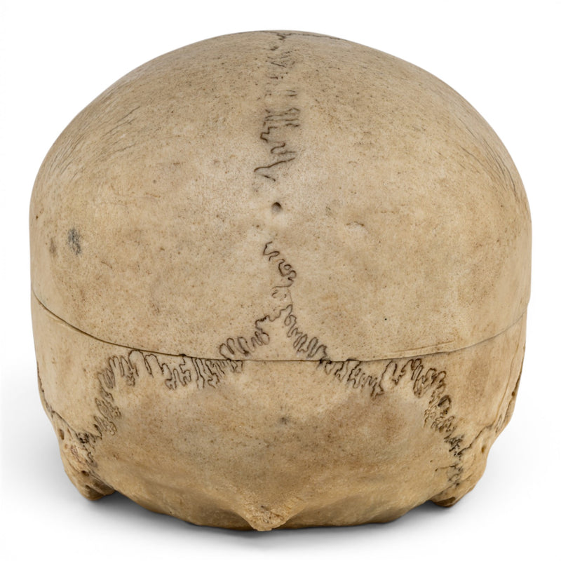 Real Human Skull No Jaw
