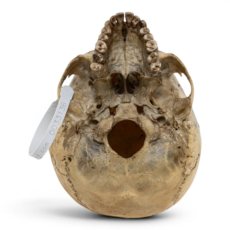 Real Human Skull No Jaw