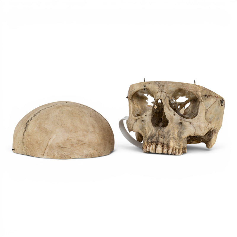 Real Human Skull No Jaw