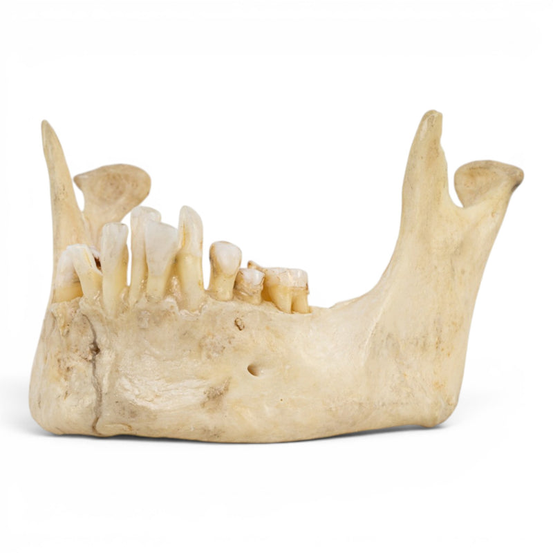 Real Human Mandible