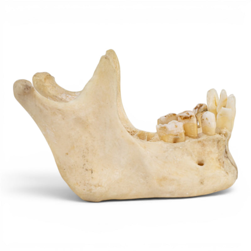 Real Human Mandible