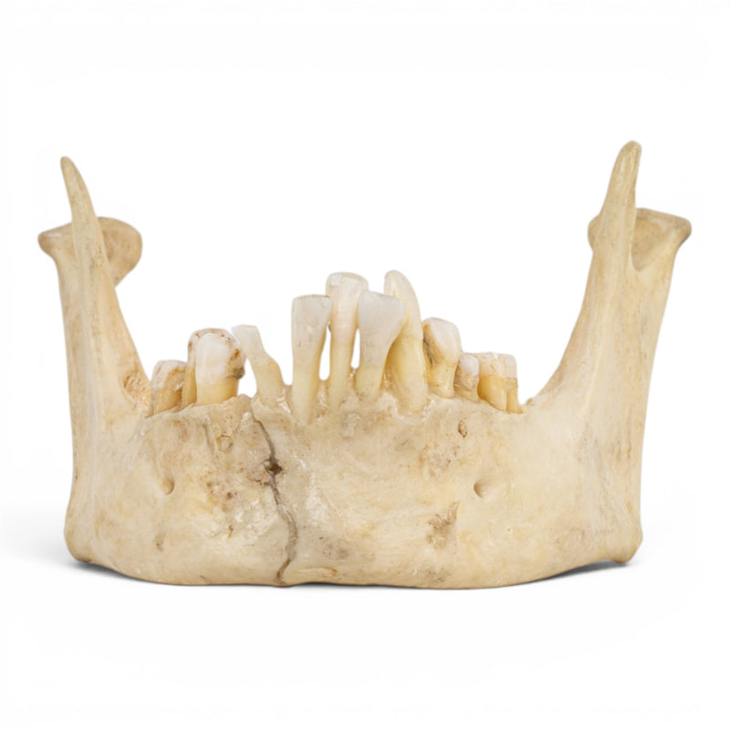 Real Human Mandible
