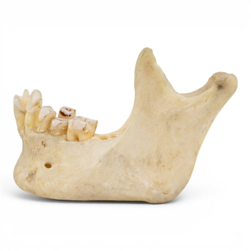 Real Human Mandible