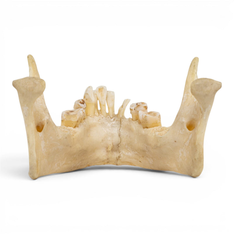 Real Human Mandible