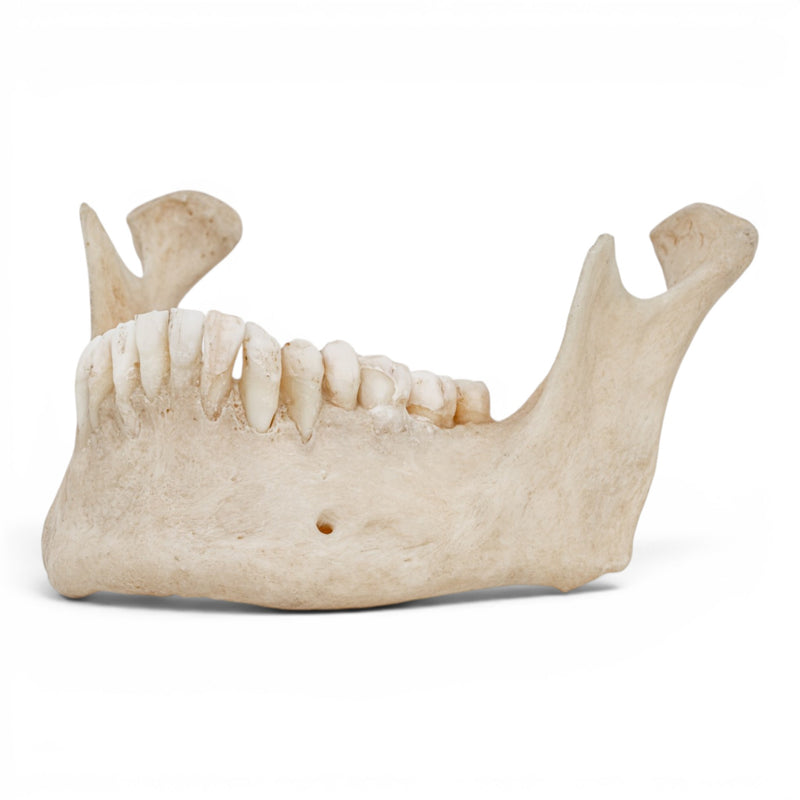 Real Human Mandible