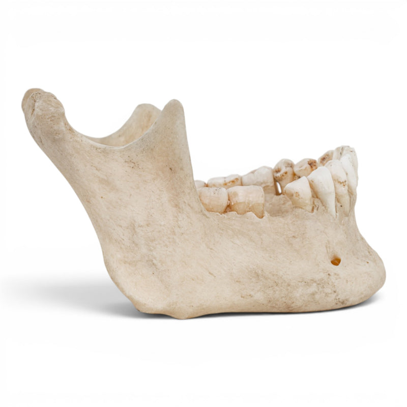 Real Human Mandible