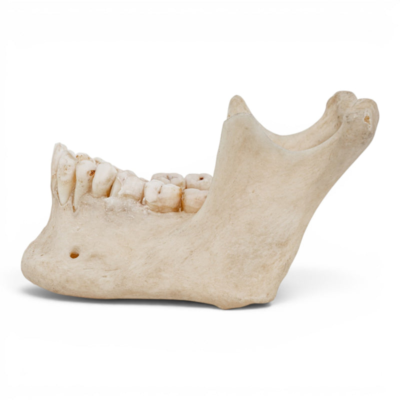 Real Human Mandible