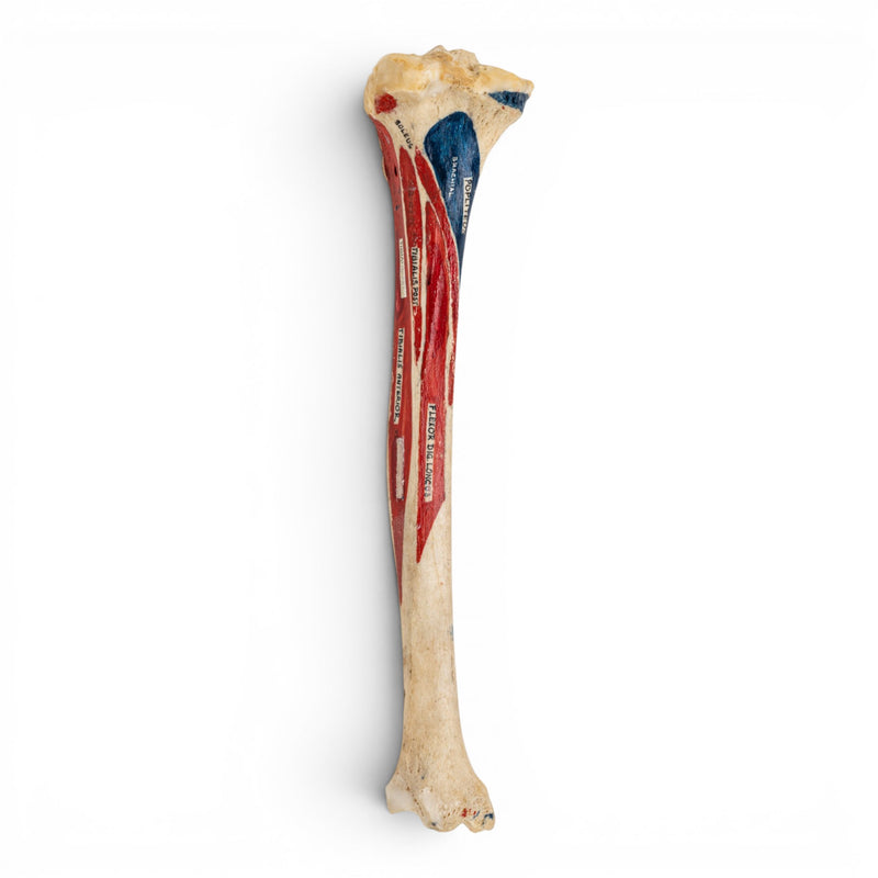 Real Human Tibia - Painted
