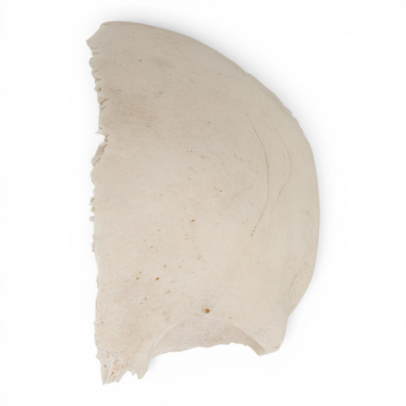 Real Partial Human Frontal Bone - Child