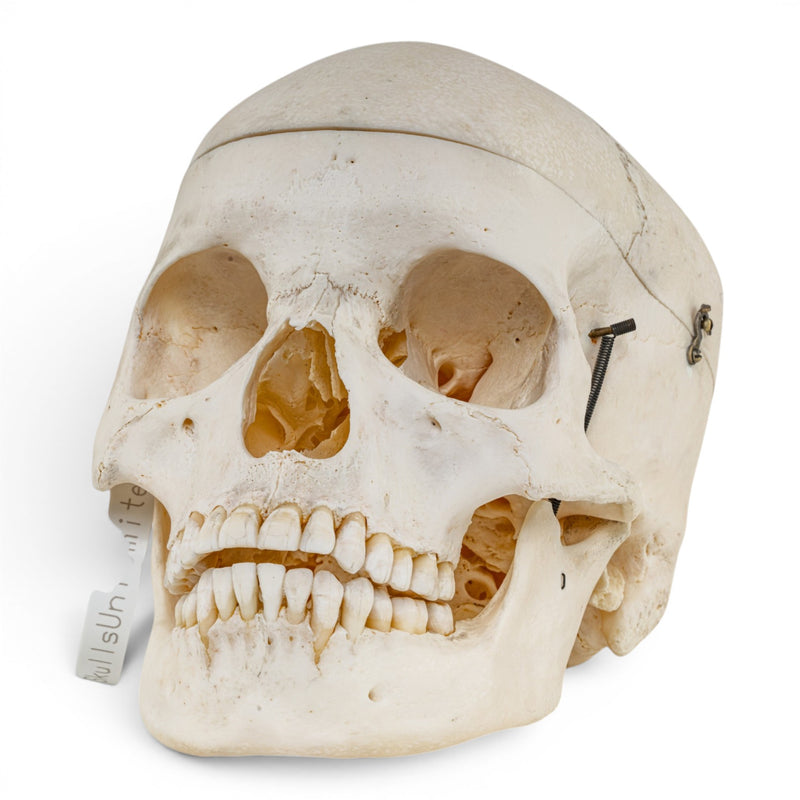 Real Human Skull