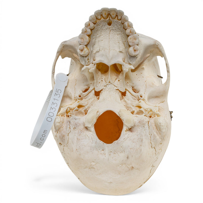 Real Human Skull