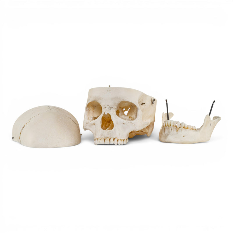 Real Human Skull
