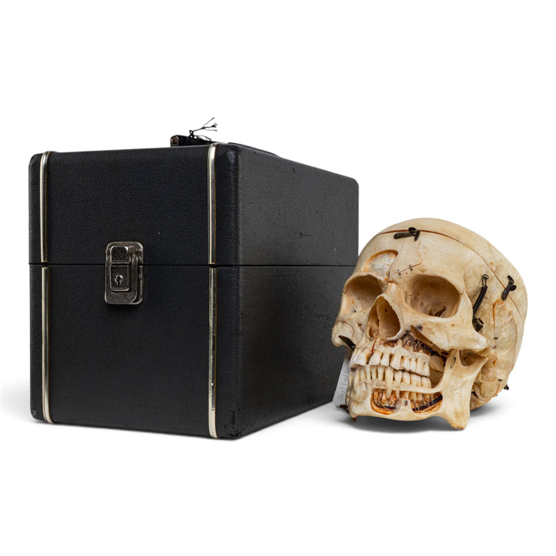 Real Human Skull - Dissected - with Carrying Case
