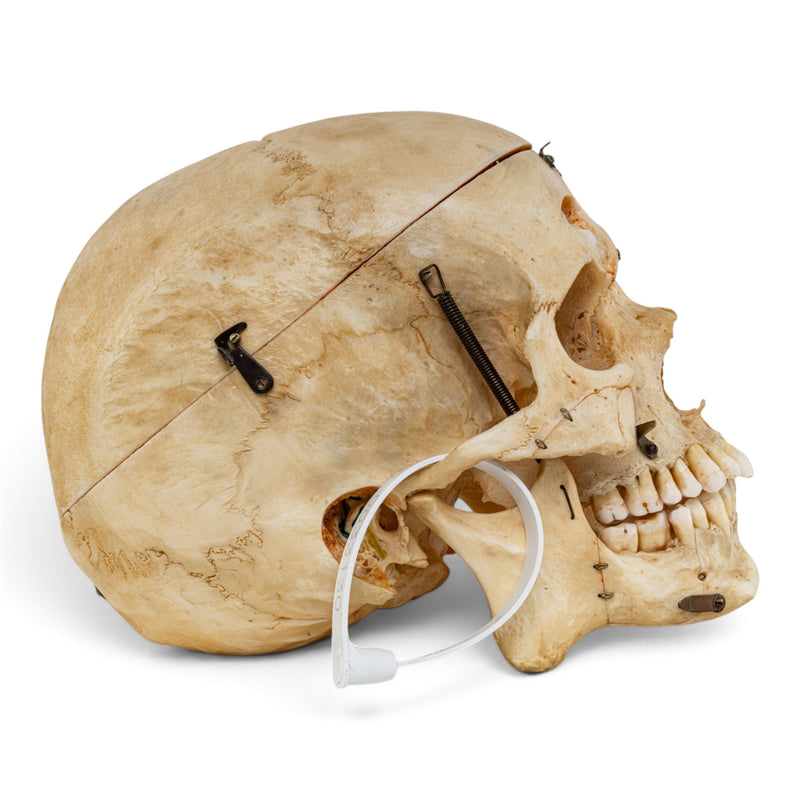 Real Human Skull - Dissected - with Carrying Case