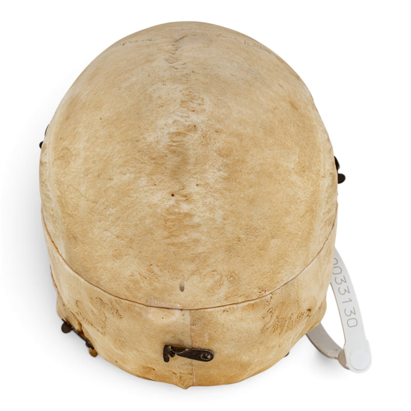 Real Human Skull - Dissected - with Carrying Case