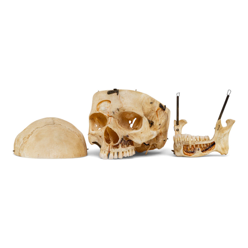 Real Human Skull - Dissected - with Carrying Case