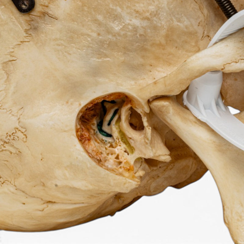 Real Human Skull - Dissected - with Carrying Case
