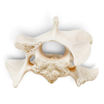 Real Wolf Vertebra - Pathology