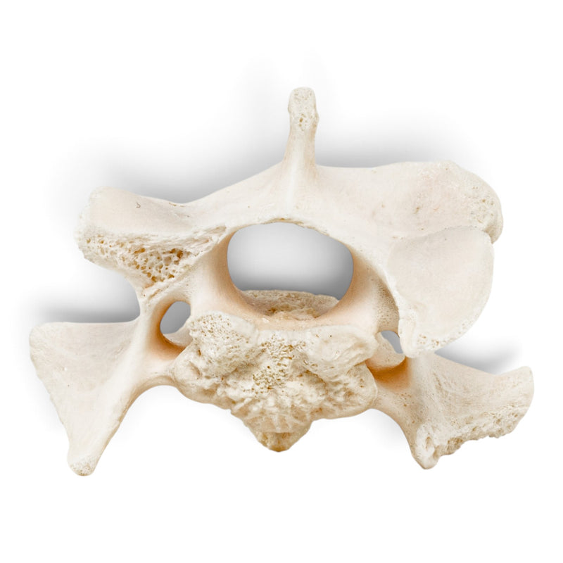 Real Wolf Vertebra - Pathology